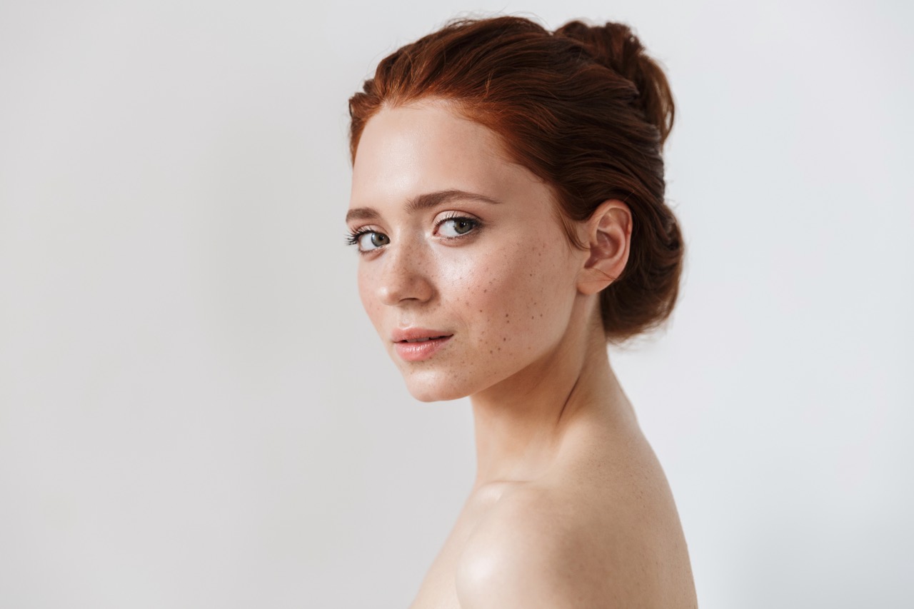 Semi-Permanent Freckles (freckle tattooing) - healed result